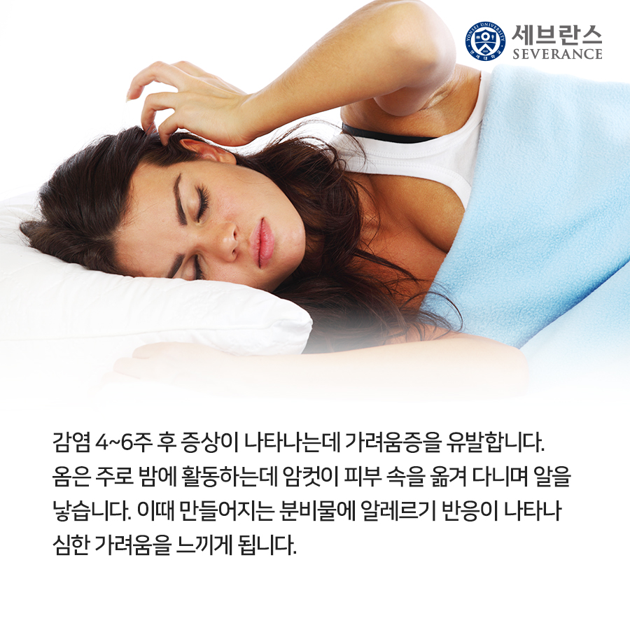 감염 4~6주 후 증상이 나타나는데 가려움증을 유발합니다. 옴은 주로 밤에 활동하는데 암컷이 피부 속을 옮겨 다니며 알을 낳습니다. 이때 만들어지는 분비물에 알레르기 반응이 나타나 심한 가려움을 느끼게 됩니다.