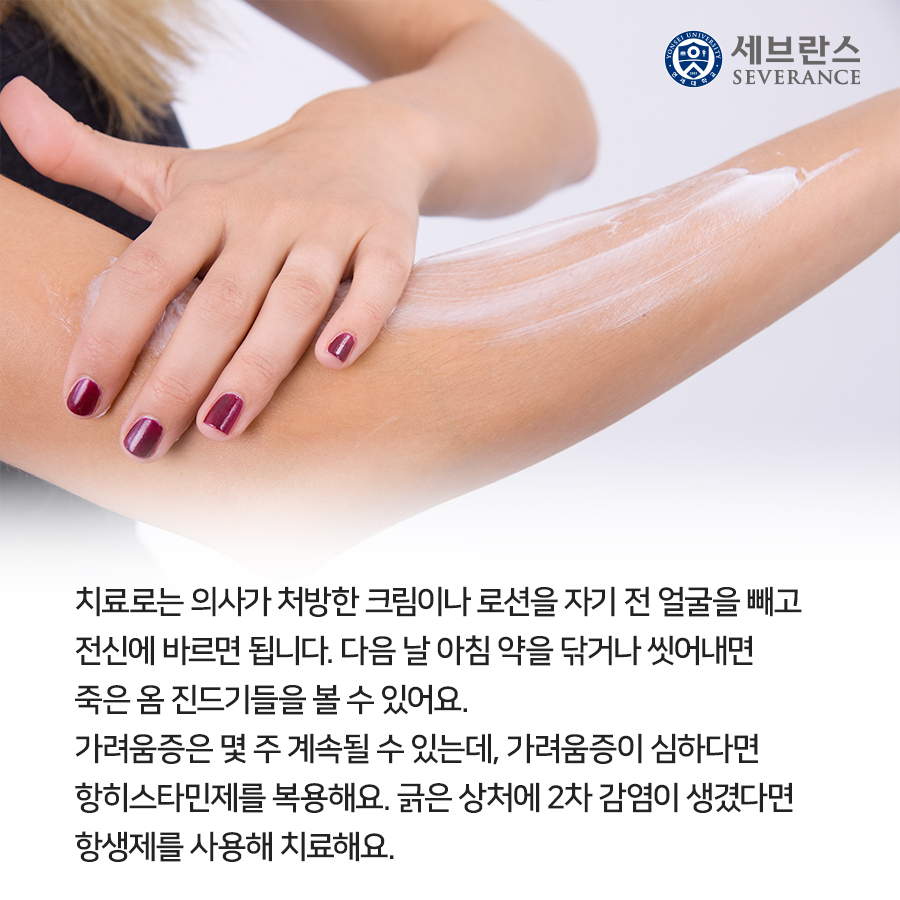 치료로는 의사가 처방한 크림이나 로션을 자기 전 얼굴을 빼고 전신에 바르면 됩니다.  다음 날 아침 약을 닦거나 씻어내면 죽은 옴 진드기들을 볼 수 있어요. 가려움증이 심하다면 항히스타민제를 복용해요. 긁은 상처에 2차 감염이 생겼다면 항생제를 사용해 치료해요.